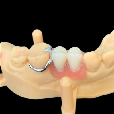 Dental Unilaterali CoCr Metal Framework Denture Parzjali